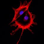 Confocal microscopy imaging of two cancer cells touching each other. Cytoskeletal protein actin in red, nucleus in blue.
